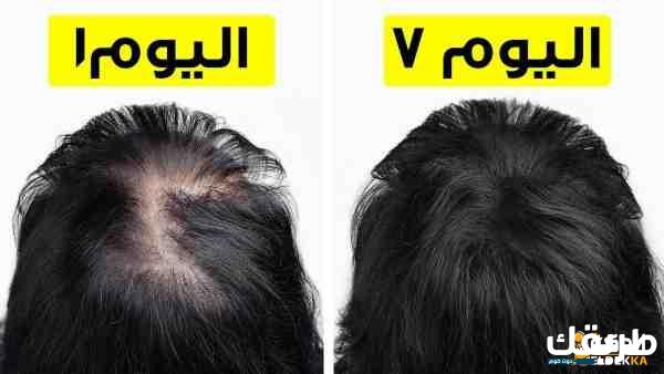 تعرفي علي أفضل خلطة مجربة لتكثيف الشعر 7 خلطات تقوية وتكثيف الشعر